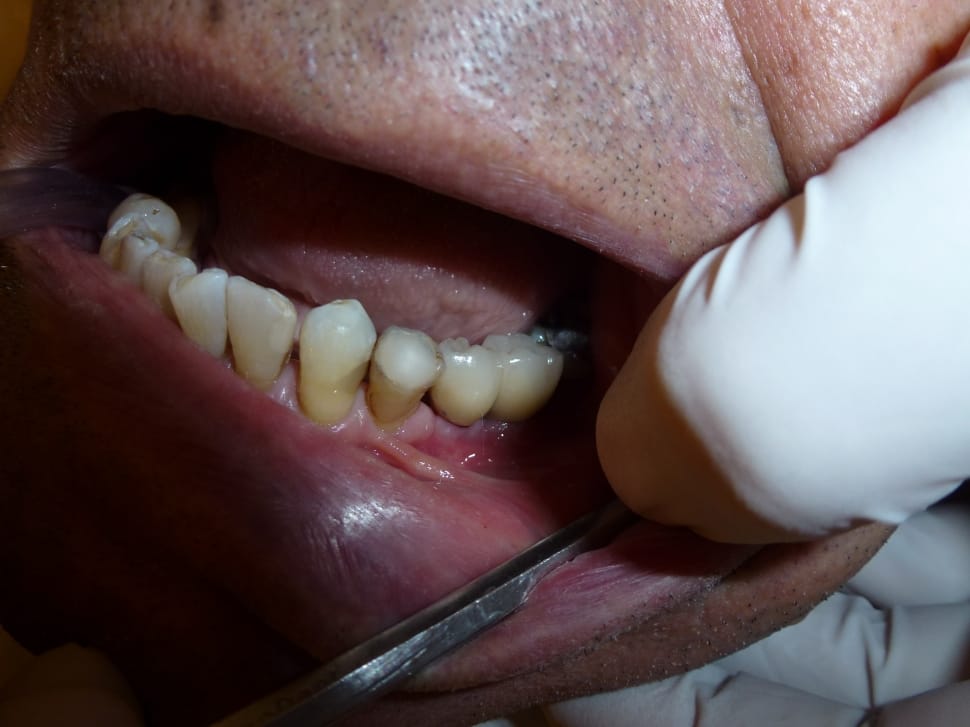 human teeth preview