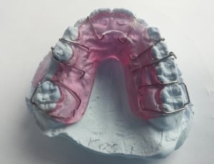 pink and blue teeth mold thumbnail