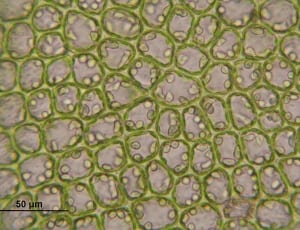 brown and green microorganism thumbnail