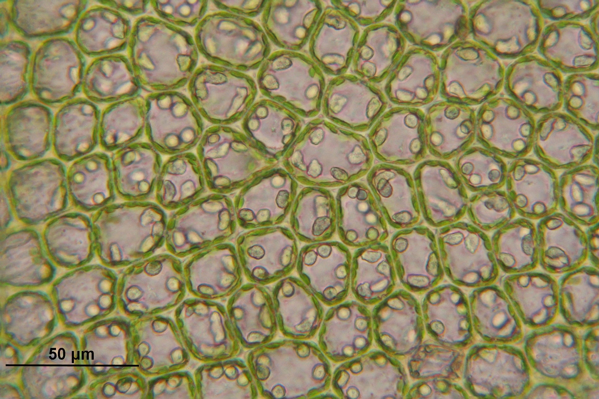 brown and green microorganism