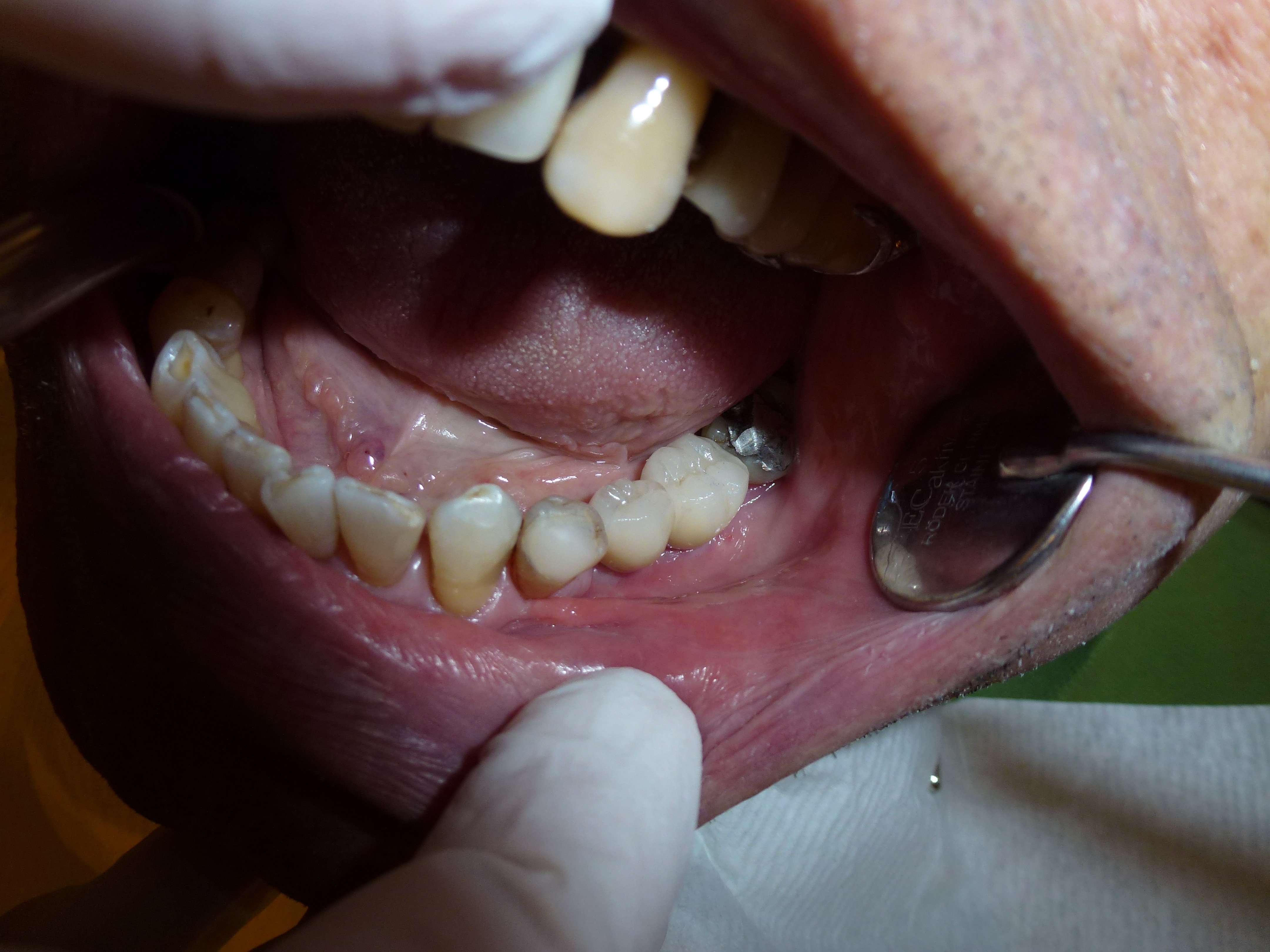 human teeth