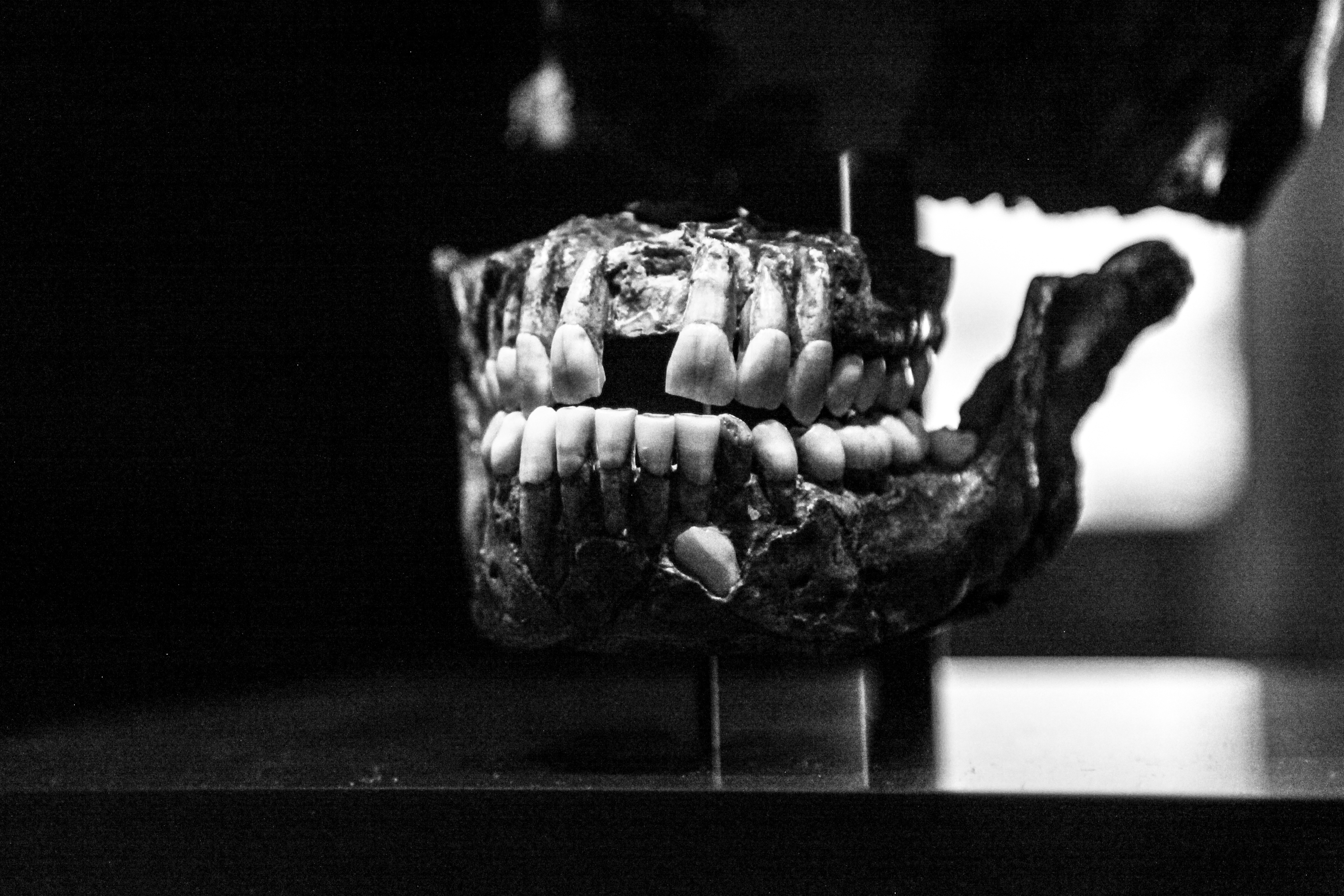 gray scale photo of dental dentures